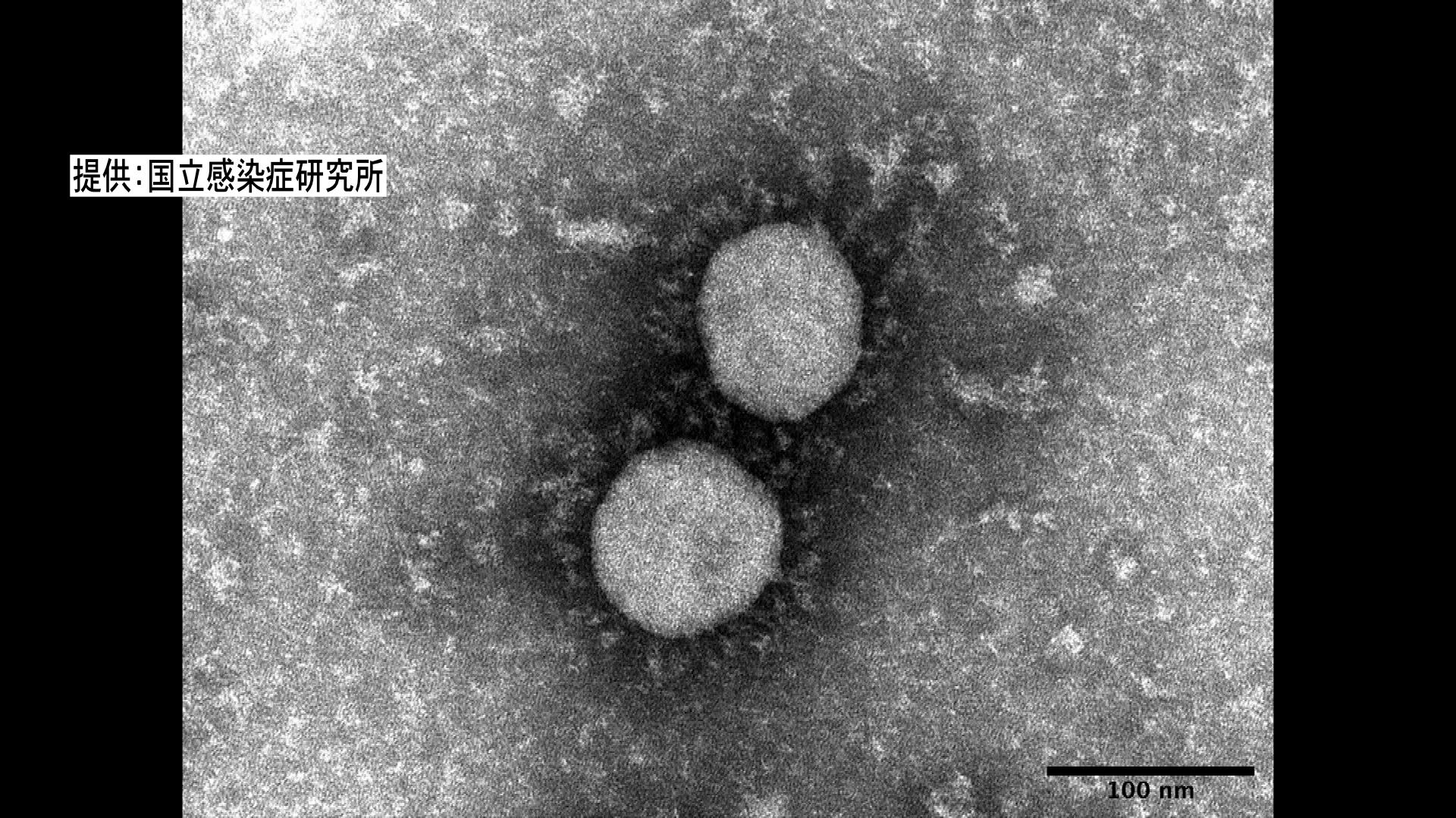 ☆確認用☆ 県内初確認 新型コロナ“デルタ株” | オピニオン室